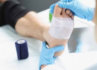 Luka kaki Diabetes